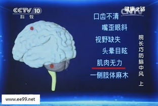 院长巧防脑中风是健康之路第几集