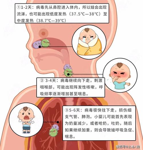 病毒肺炎症状全解析保护自己，关爱他人