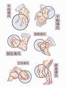 痛风有哪些症状表现？