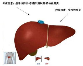 【健康科普】乙肝症状早知道，健康生活从预防开始！