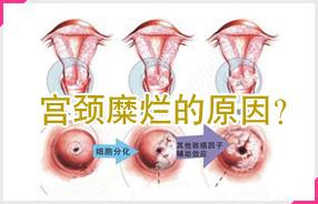 1.异常阴道分泌物